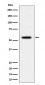 Anti-Phospho-Vimentin (S39) Rabbit Monoclonal Antibody